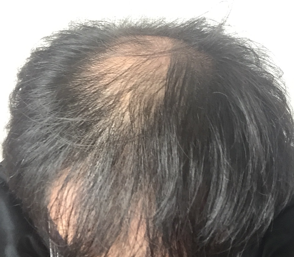 AGA,�n�Q,����,AGA����