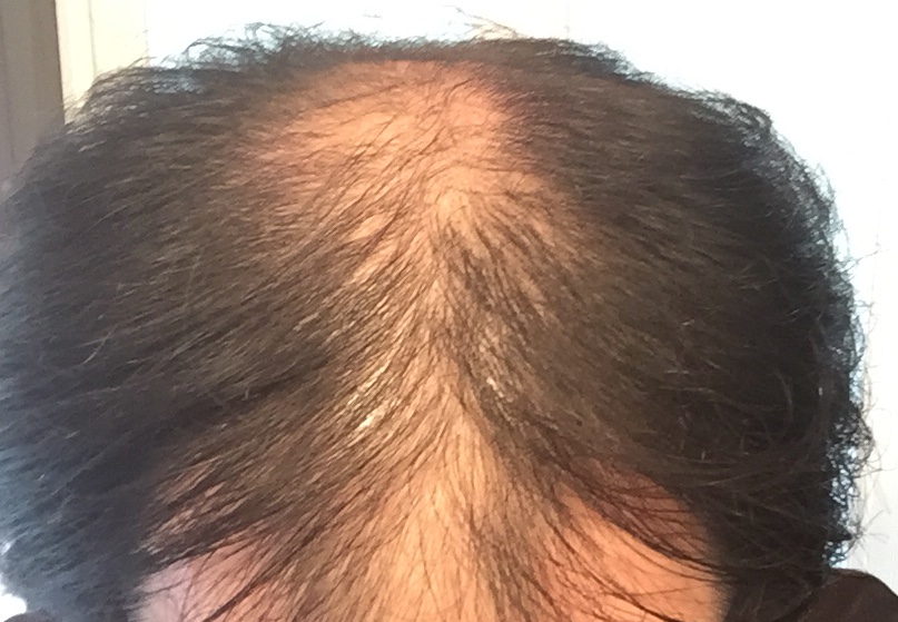 AGA,�n�Q,����,AGA����