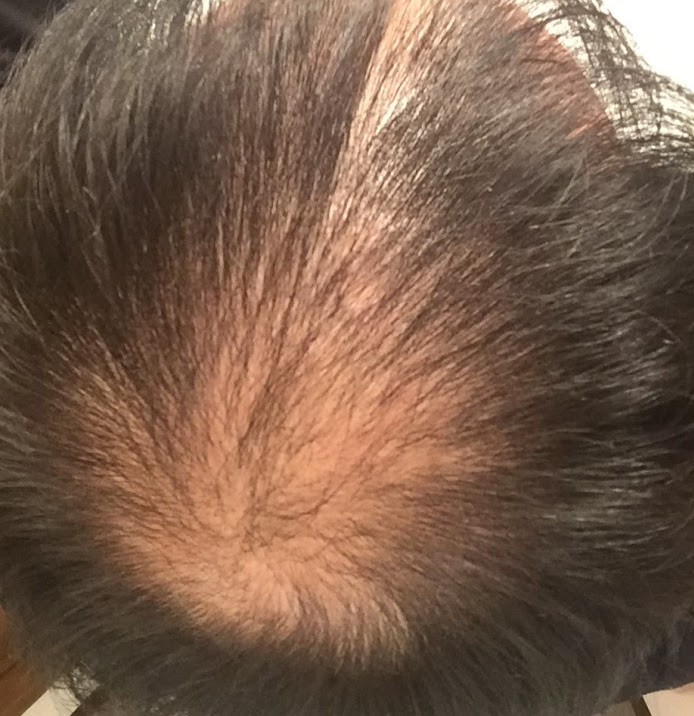 AGA,�n�Q,����,AGA����